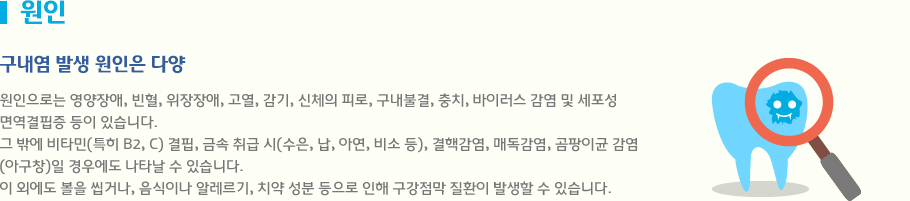 구내염 발생 원인은 다양 원인으로는 영양장애, 빈혈, 위장장애, 고열, 감기, 신체의 피로, 구내불결, 충치, 바이러스 감염 및 세포성 
면역결핍증 등이 있습니다.